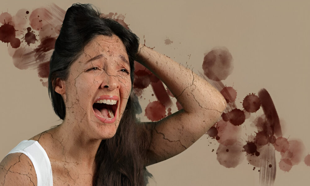 Bodas de sangre PALM